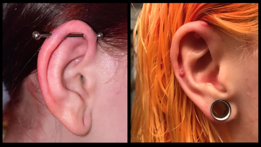 Špatná anatomie industrial piercingu