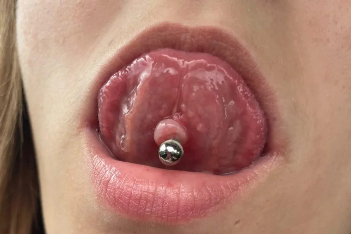 Boulička u piercingu v jazyku